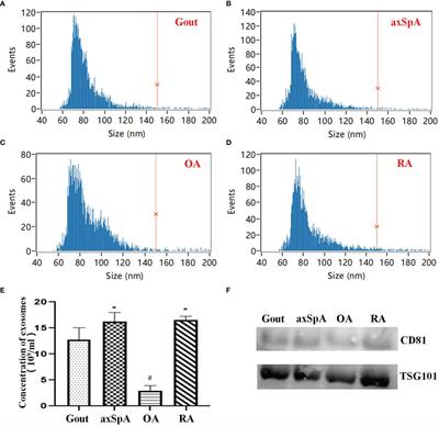 <mark class="highlighted">TMT-Based Quantitative Proteomics</mark> Analysis of Synovial Fluid-Derived Exosomes in Inflammatory Arthritis
